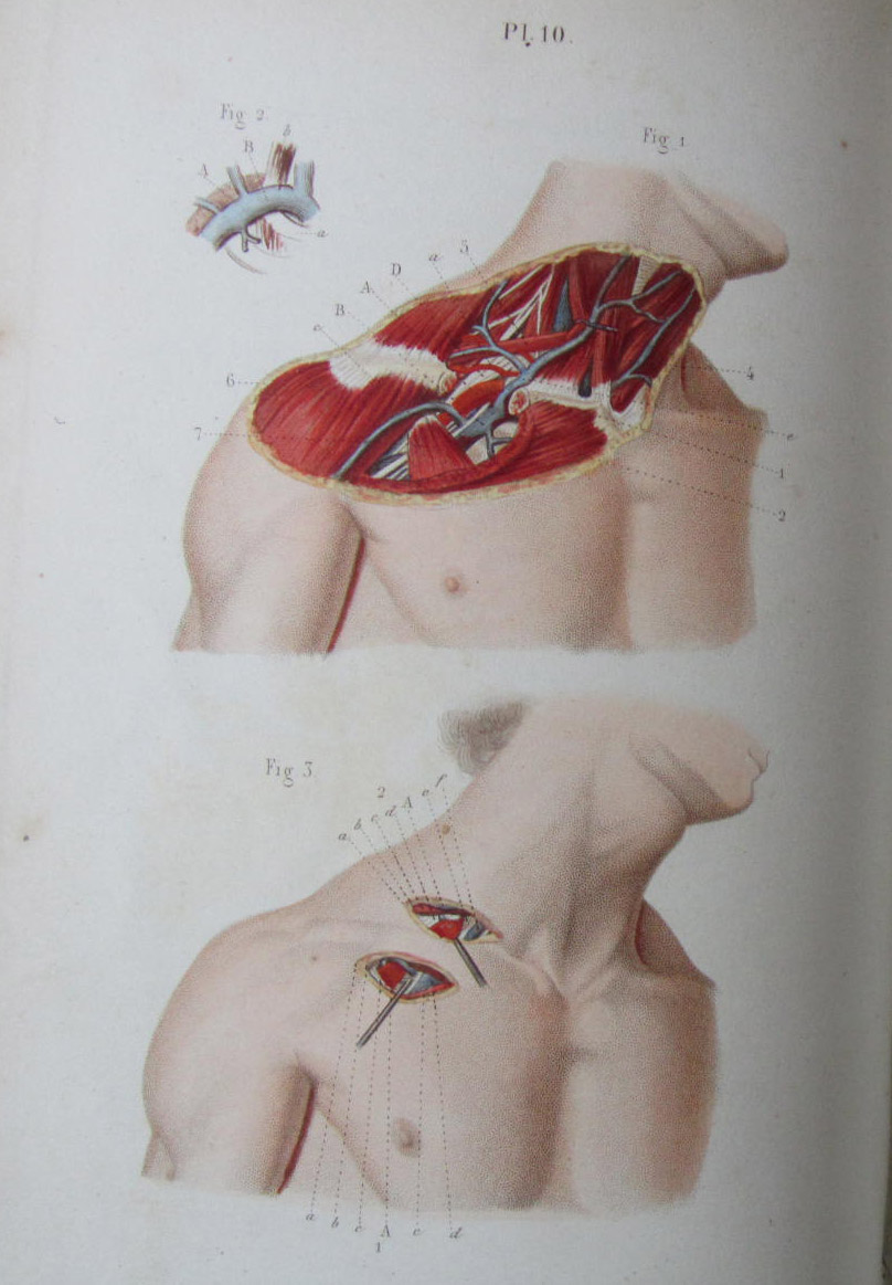 United States Medicine -- nineteenth century works, including Smith, Nathan R.