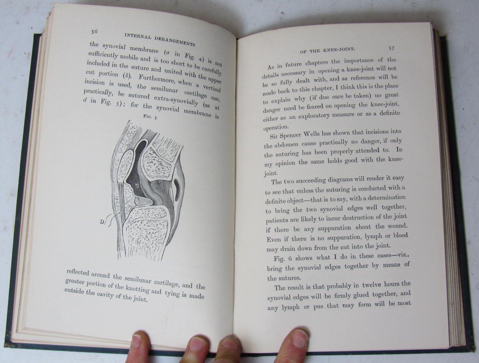British and American medicine, 19th century, a large quantity, including Longmore, T.