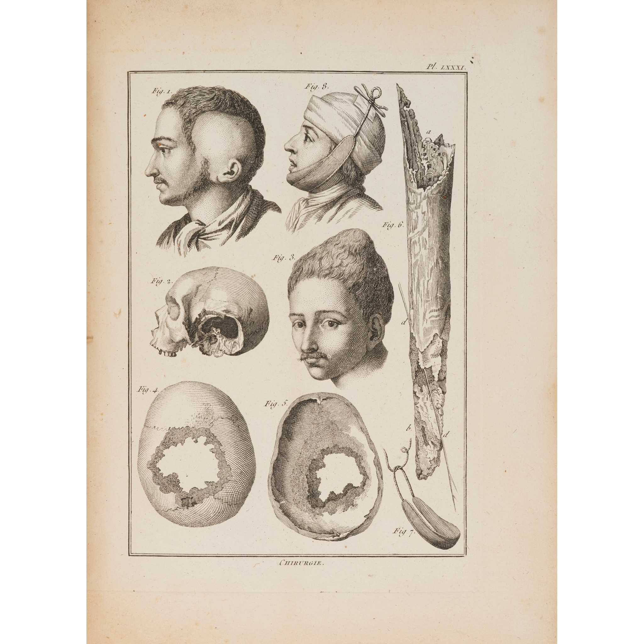 Medicine and Surgery - 18th century
