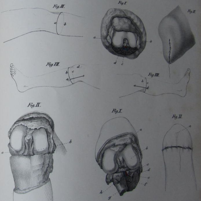 Günther, Gustave Biedermann