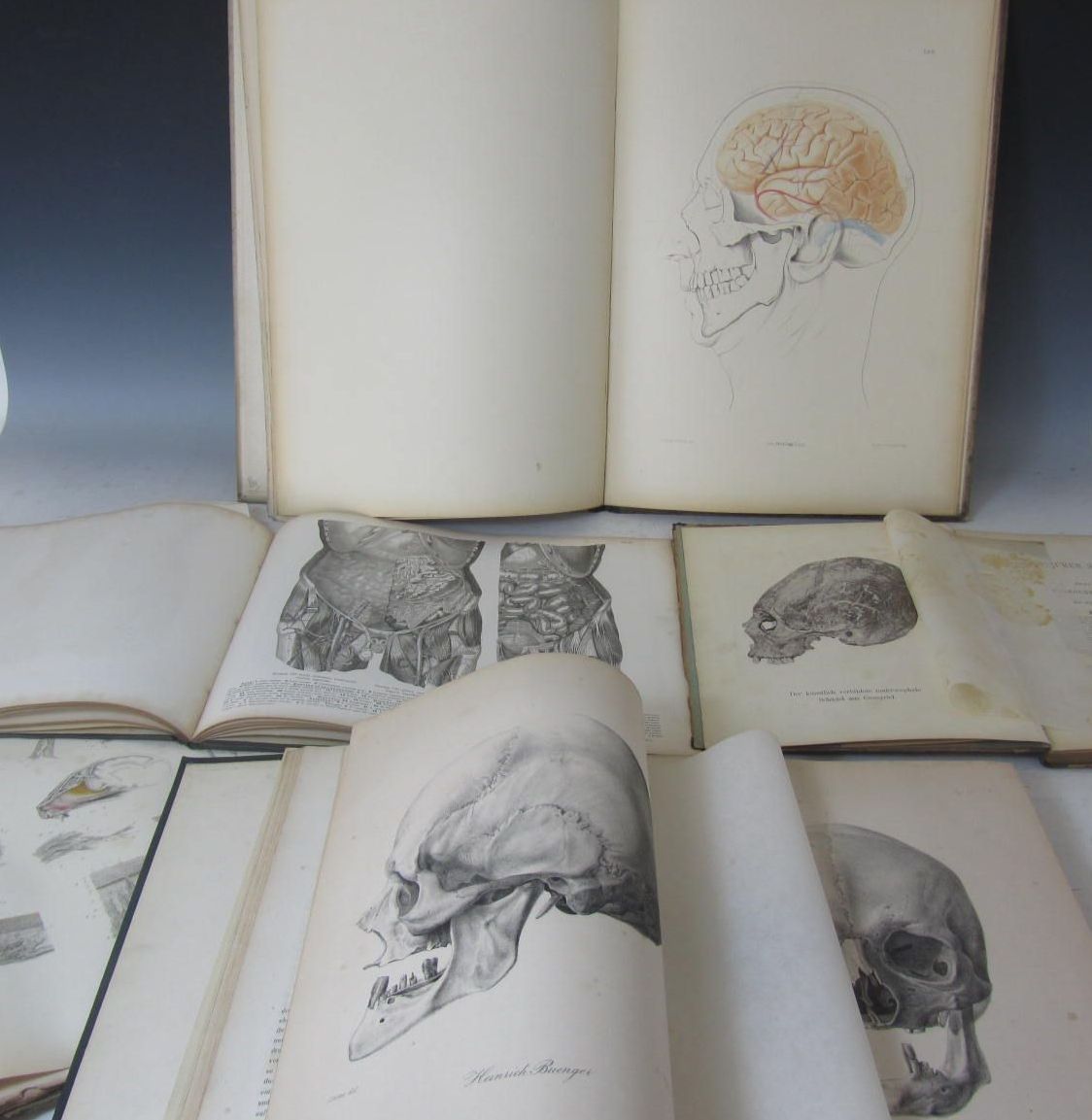 Albers, Johannes Abraham