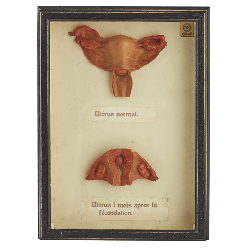 SIX CASED WAX MODELS OF HUMAN GESTATION