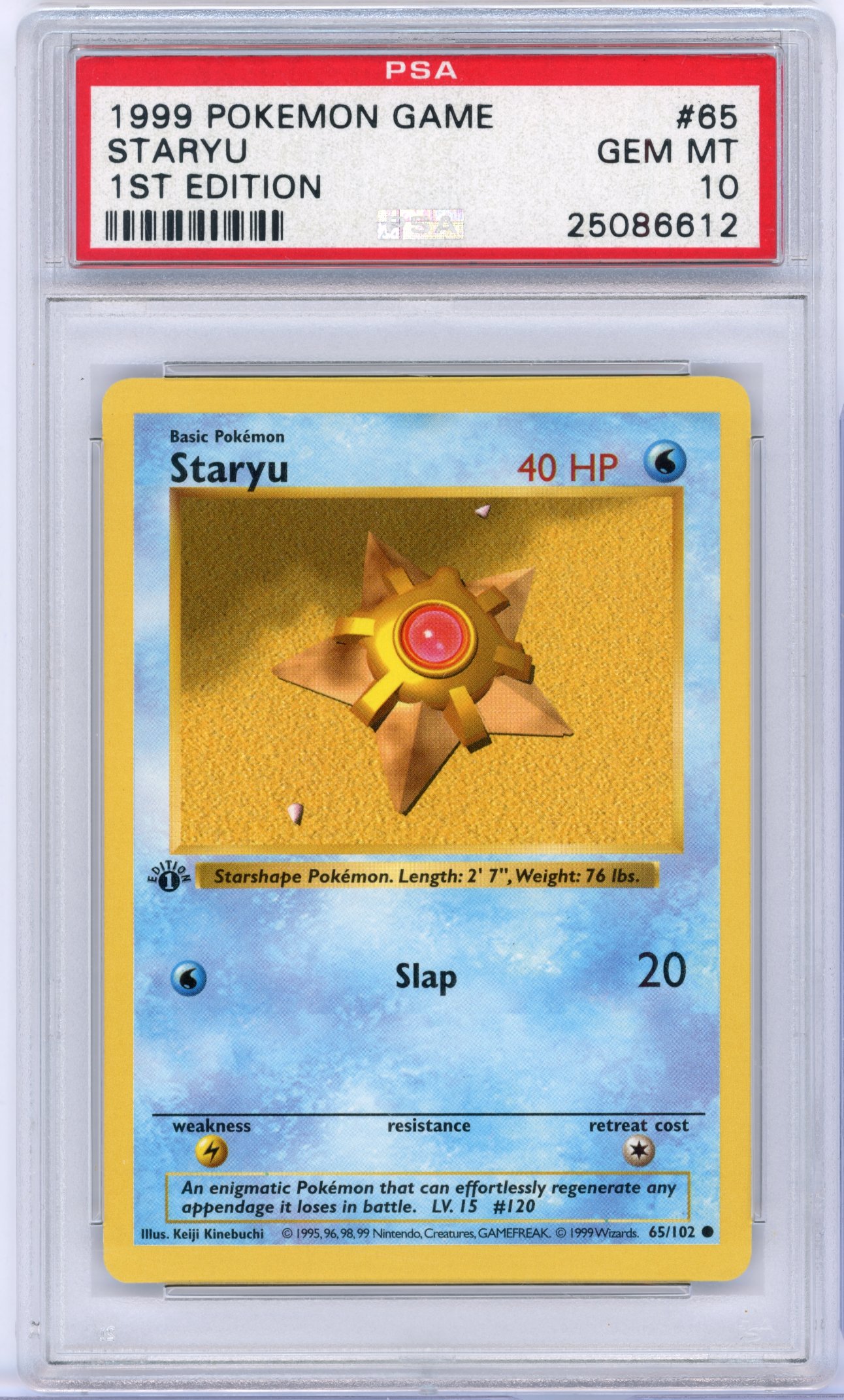 PSA 10 Staryu #65 1st Edition Shadowless Base Set